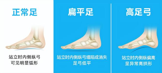 中国家长都忽视的足弓健康安踏儿童偏要押重注！(图1)